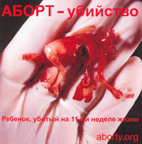 Аборт - убийство!